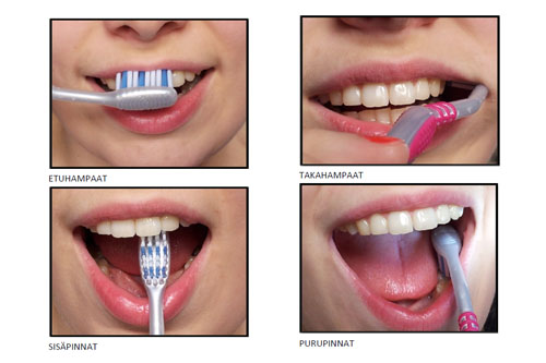 Neljä valokuvaa henkilön avoimesta suusta ja siellä olevasta hammasharjasta hampaidenpesun eri vaiheissa.